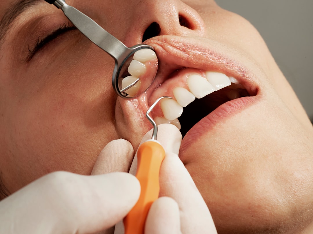 Root canal treatment